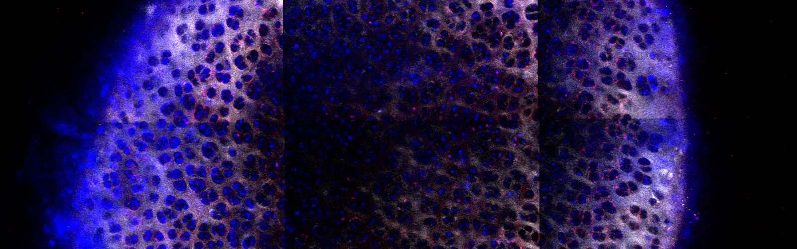 Researchers engineered dendrimers to deliver IGF-1 to cartilage, enhancing treatment for osteoarthritis. Decorative image shows the cartilage in a fluorescent micrograph. Fluorescently labeled dendrimer in blue is shown to penetrate the cartilage.