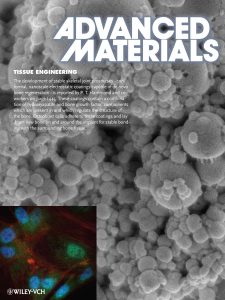 Decorative journal cover. The development of stable skeletal joint prostheses - con-formal, nanoscale electrostatic coatings capable of de novo bone regeneration - is reported by P. T. Hammond and co-workers. These coatings contain a combination of hydroxyapatite and bone growth factor, components which are present in and which regulate the structure of the bone. Osteoblast cells adhere to these coatings and lay down new bone on and around the implant for stable bonding with the surrounding bone tissue.