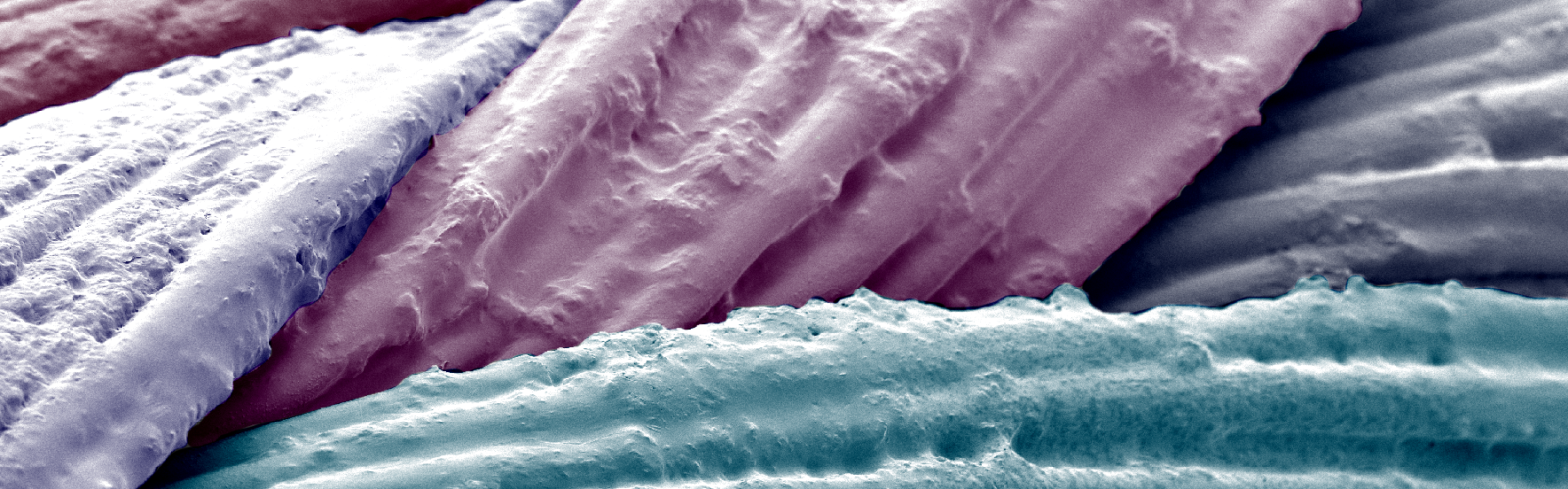 Decorative image for research optimizing the solution conditions in formulating electrostatically assembled siRNA-coated sutures. Image depicts the braided strands of a suture with SEM imaging. A thin film coating can be seen on the strand surfaces. Each strand artificially colored.
