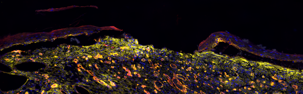 A decorative microscopic image of skin wound tissue immunofluorescently stained. Cell nuclei are in blue, integrin alpha 5 (a cell mechanotransduction protein) is in yellow and blood vessels are in red.